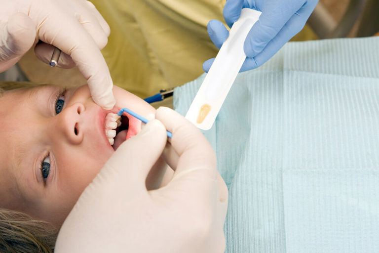 A dentist applies a fluoride treatment to a child's teeth during a dental checkup