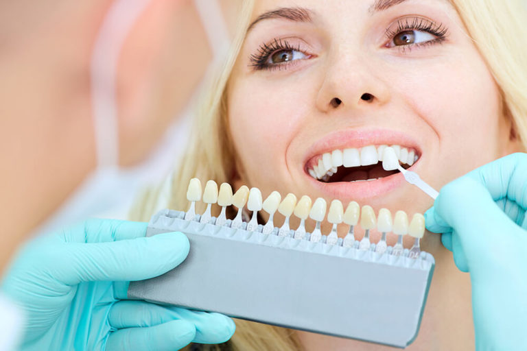 A dentist holds a whitening scale up to a female dental patient's teeth to compare degrees of whiteness